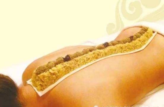 扶阳养阳之“长蛇灸”